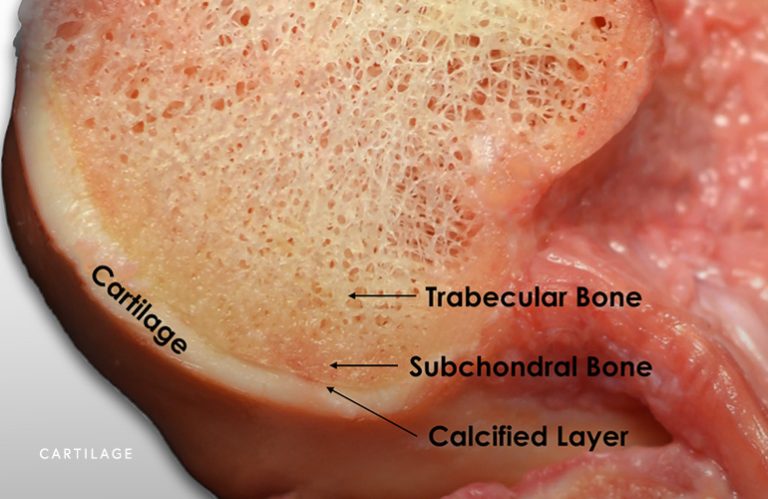 chondral-defect-knee-chicago-il