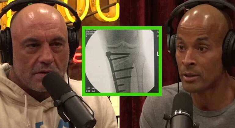 Hto Meaning Xxx Video - High Tibial Osteotomy: Separating Fact From Fiction in Joe Rogan's Podcast  with David Goggins | Dr. Jorge Chahla